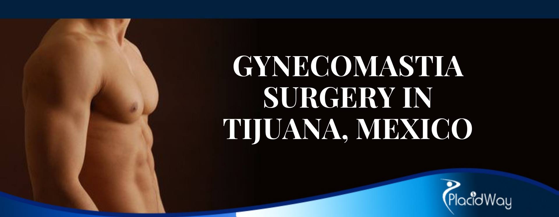 GynecomastIa Surgery in Tijuana, Mexico